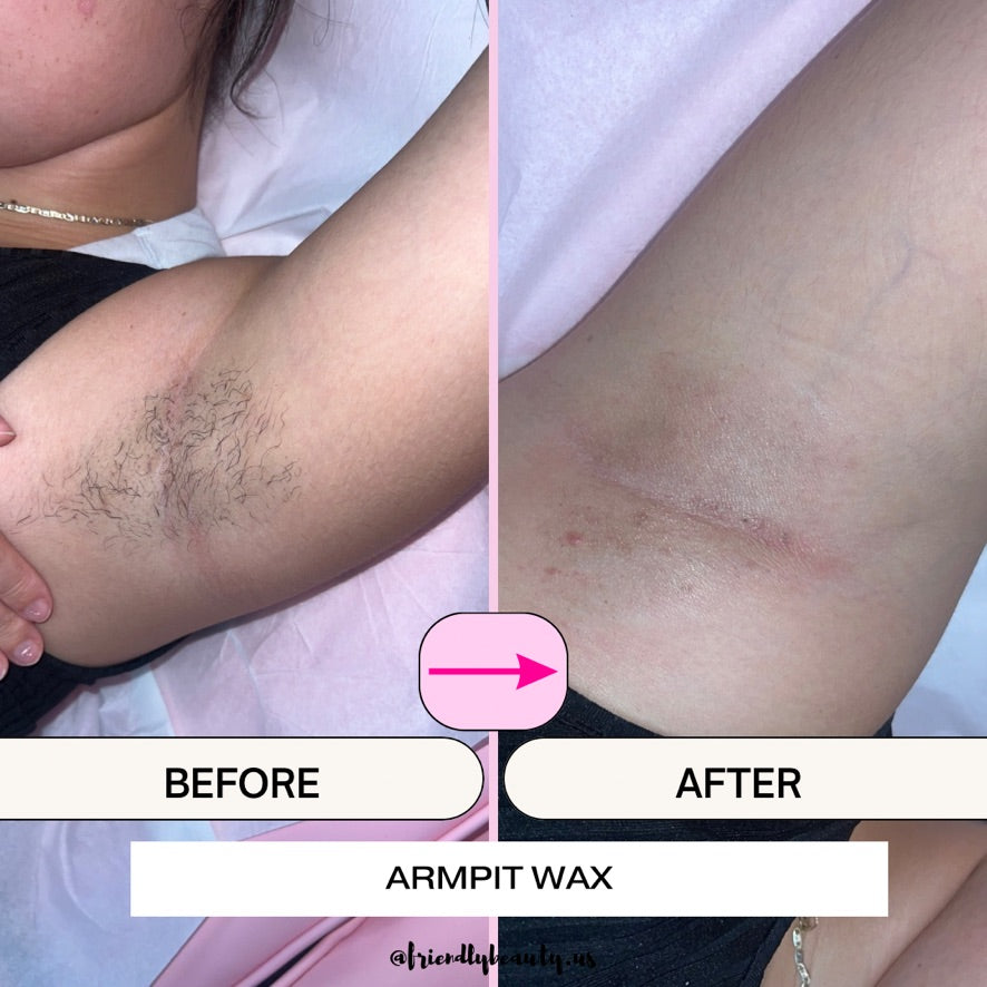What To Do Before And After Waxing Armpits what-to-do-before-and-after-waxing-armpits